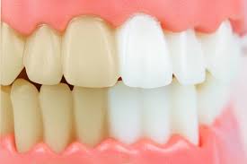 Liquide dentifrice contre la mauvaise haleine