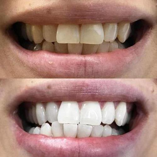 Liquide dentifrice contre la mauvaise haleine