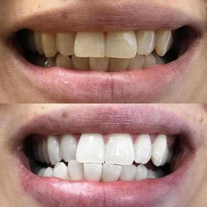 Liquide dentifrice contre la mauvaise haleine